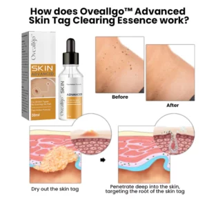 Oveallgo™ Advanced Skin Tag Clearing Essence