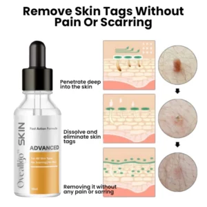 Oveallgo™ Advanced Skin Tag Clearing Essence