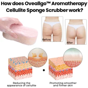 Alternative view of Oveallgo™ Aromatherapy Cellulite Sponge Scrubber