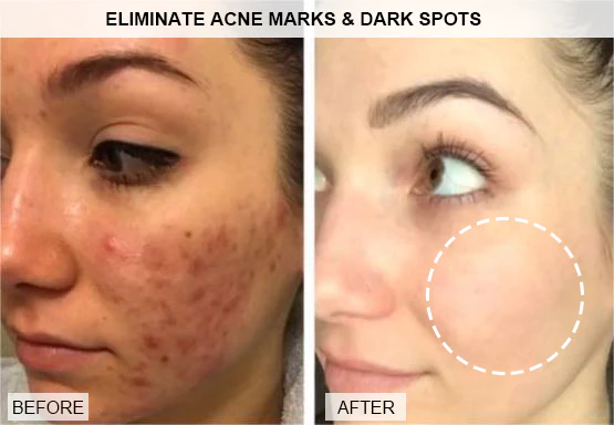 Collagen-Boost Lift Anti-Aging Cream - Image 5