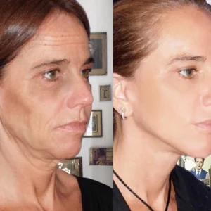 Oveallgo™ Collagen-Boost Lift Anti-Aging Cream
