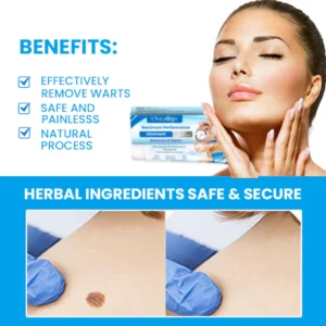 Oveallgo™ Maximum Performance Ointment for the Immediate removal of Warts