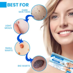 Oveallgo™ Maximum Performance Ointment for the Immediate removal of Warts