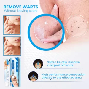 Oveallgo™ Maximum Performance Ointment for the Immediate removal of Warts