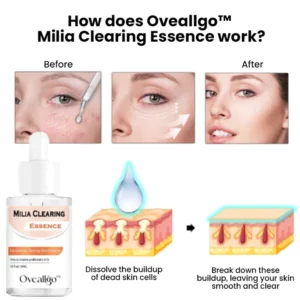Oveallgo™ Milia Clearing Essence