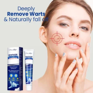 Oveallgo™ WartsOff Professional Blemish Removal Cream