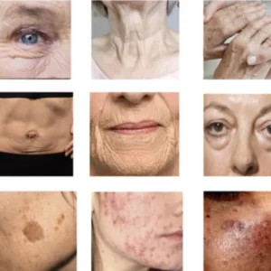 Oveallgo™ YOUNG Golden Age Refining Anti-Aging Serum