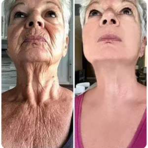 Oveallgo™ YOUNG Golden Age Refining Anti-Aging Serum
