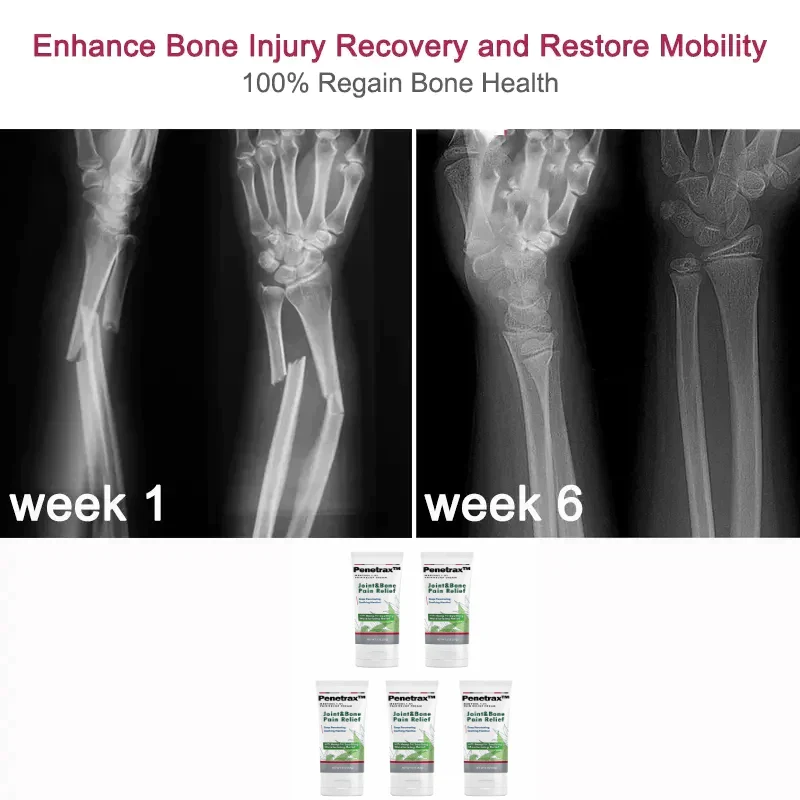 Penetrax™ Joint & Bone Therapy Cream - Image 7