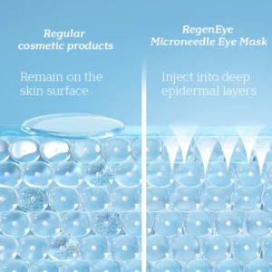 RegenEye™ Microneedle Eye Mask