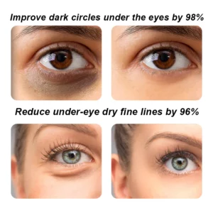 RegenEye™ Microneedle Eye Mask