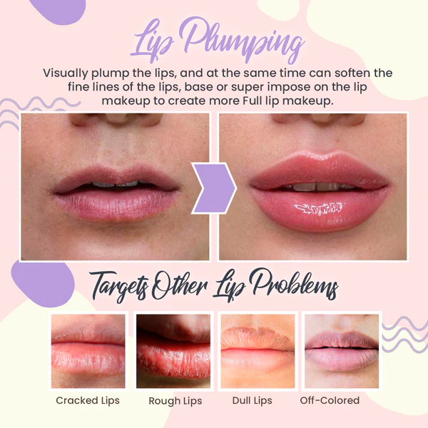 Renew™ Lip Treatment Balm - Image 4