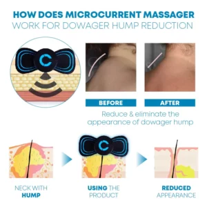 Alternative view of Ricpind ElectronicWave NeckPosture Corrector MassageDevice