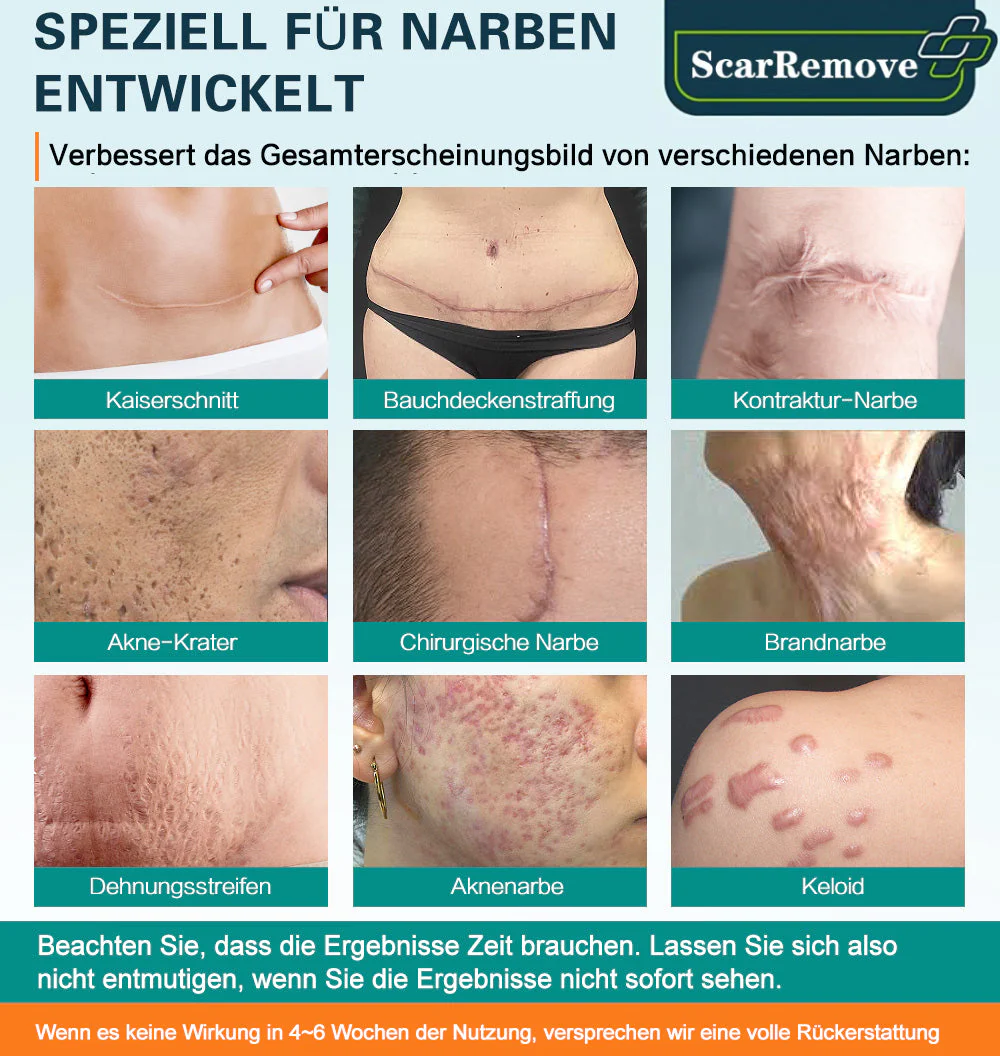 ScarRemove™ Fortgeschrittenes Narbenspray für alle Arten von Narben