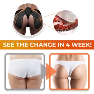 ShapeZ™ Buttock Lifting Instrument