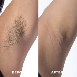 Skinetic™ Advanced Hair Removal Cream