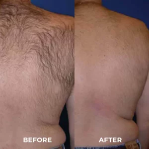 Skinetic™ Advanced Hair Removal Cream