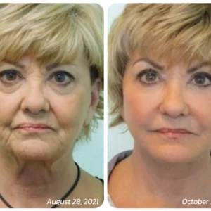 TLOPA™ Pureskin Korean Soluble Collagen Film