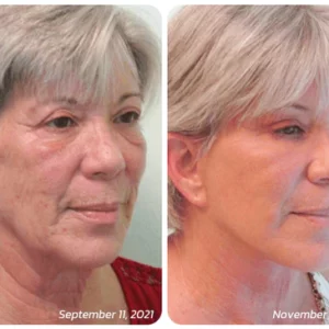 TLOPA™ Pureskin Korean Soluble Collagen Film