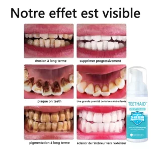 Teethaid™ Bain de bouche