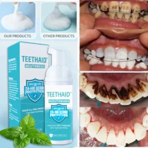 Teethaid™ Mundspülung