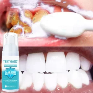 Teethaid™ Mundspülung