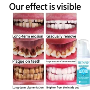 Teethaid™ Mundspülung