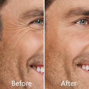 WRINKLEAWAY™ EYE OIL