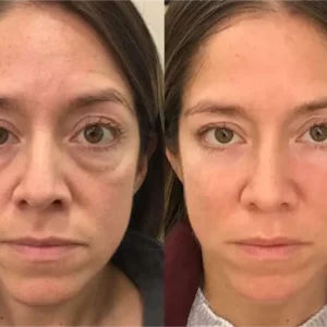 WRINKLEAWAY™ Growth Factor Firming Eye Oil