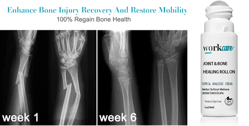 Workcare ™ Joint & Bone Healing Roll On - Image 5