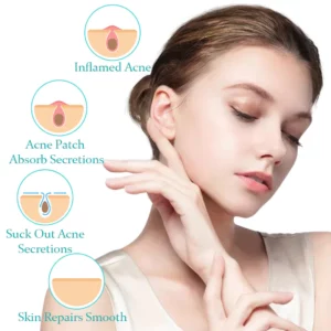 ACRēN™ Hydrocolloid Face Patches