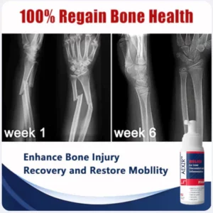 AEXZR™ Joint & Bone Therapy Foam
