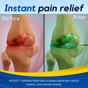 AEXZR™ JointPain Relief Mist