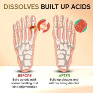 AEXZR™ Roll-On Cooling Gout Cure