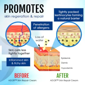 AEXZR™ Skin Repair Cream