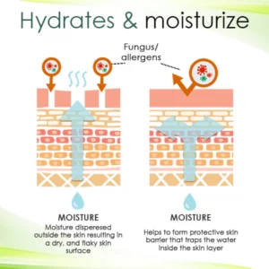 AEXZR™ Tinea Versicolor Cream