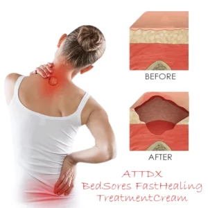 Alternative view of ATTDX BedSores FastHealing TreatmentCream