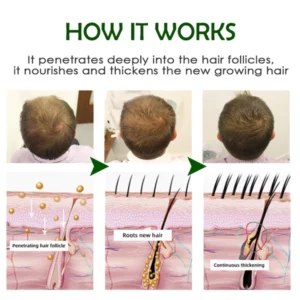 Alternative view of KoreanGinseng HairReborn Spray