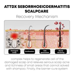 Alternative view of ATTDX SeborrhoeicDermatitis ScalpCare TreatmentCream