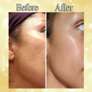 ActiveSkin Line Rewind 24K Gold Serum