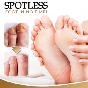 Anti-Fungal Foot Spray