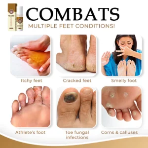 Anti-Fungal Foot Spray
