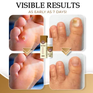Anti-Fungal Foot Spray