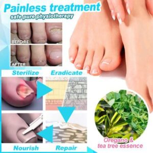 Anti-fungal Home Treatment Set
