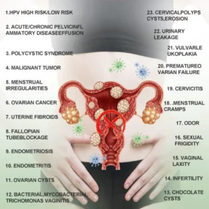 Best Anniecare® Instant Anti-Itch Detox Slimming Products