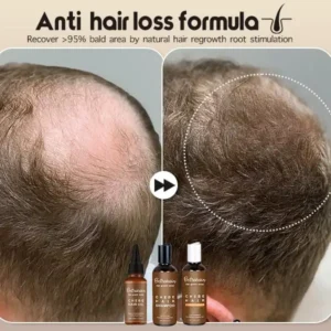 Bethahair™ Hair Regrowth African Chebe Hair Care Essentials Set