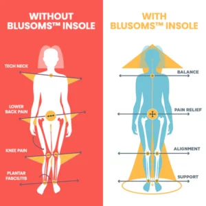 Blusoms™ Japan SlimFix Posture Correcting Insole