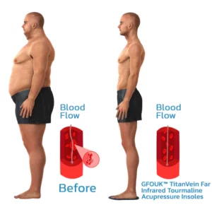 CC™ TitanVein Far Infrared Tourmaline Acupressure Insoles