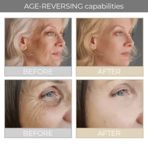 CELLvolution™ NMN Boost Aging-Treatment Cream