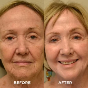 CELLvolution™ NMN Boost Aging-Treatment Cream